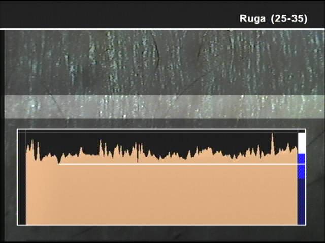 Grafico cche dimostra spessore delle rughe. Generato dal software microcamera.