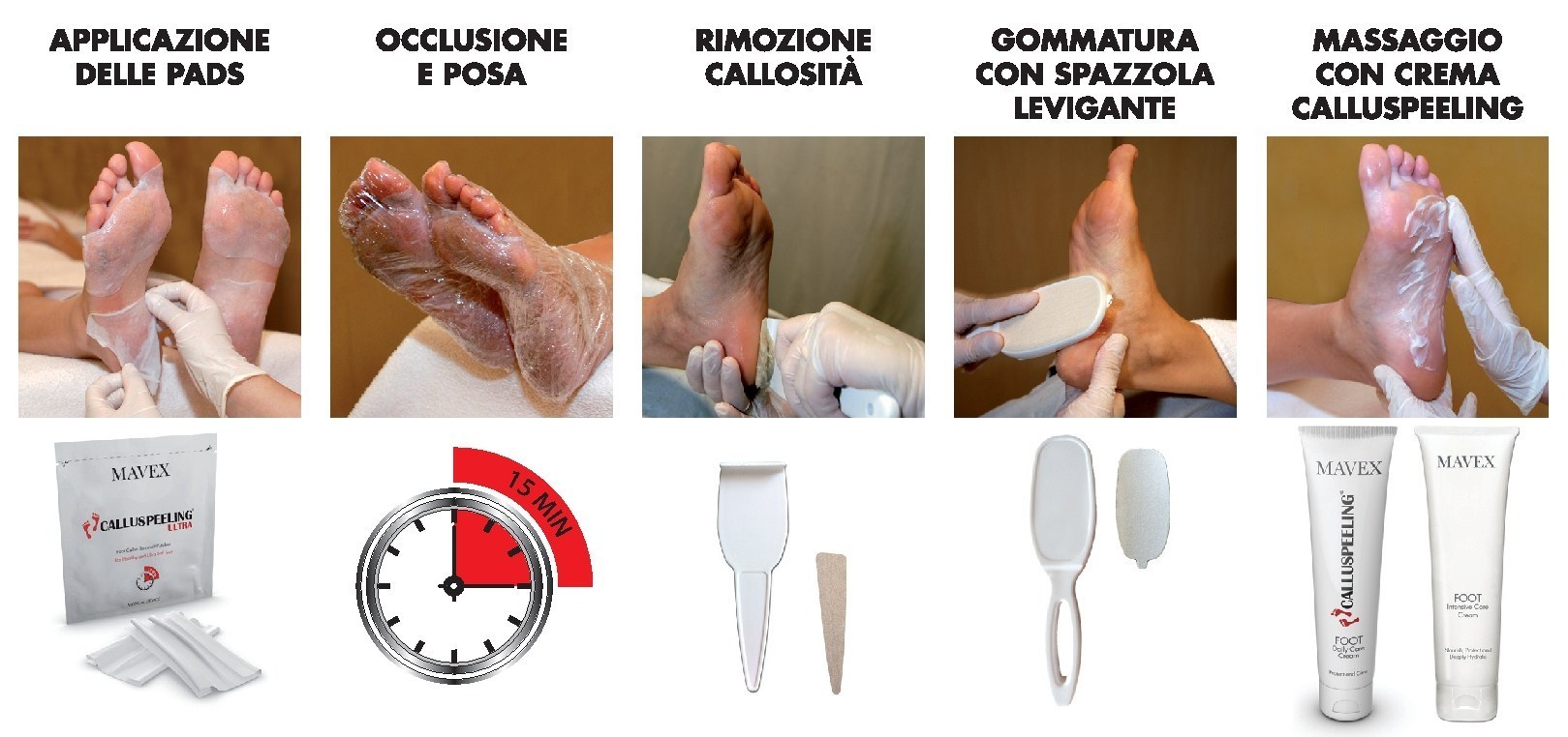 step esplicativo del trattamento calluspeeling
